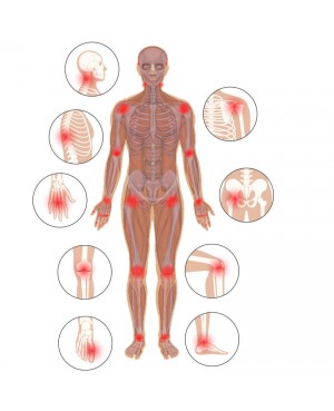 Soulager les douleurs de l’arthrose avec les aimants