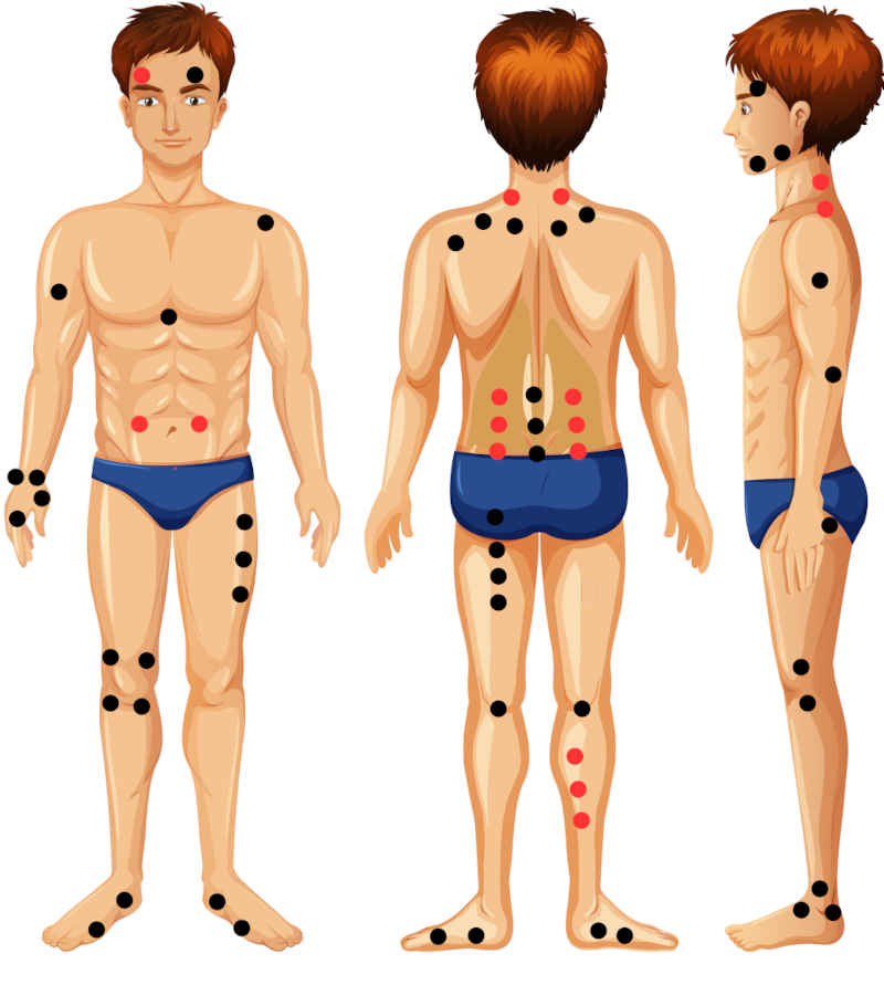 Comment placer des aimants thérapeutiques pour soulager des douleurs