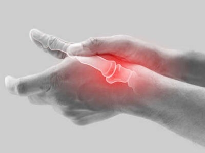 Qu'est ce que l'arthrite ? Comment soulager naturellement ?